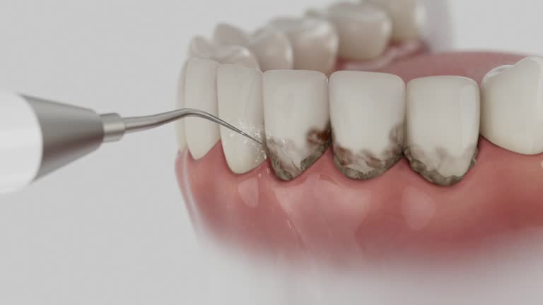 Reliable Dental Implants contractor in Baldwin, LA by Smile Center Dentistry